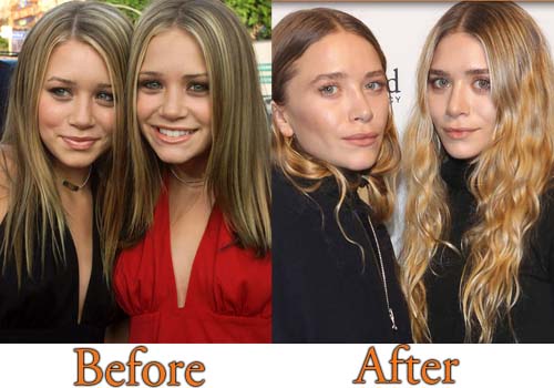 Marry Kate And Ashley Porn 88