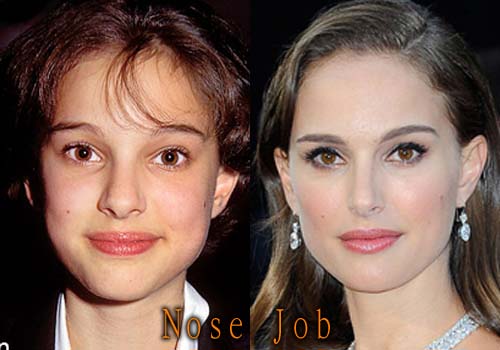 Minka Kelly Plastic Surgery Before and After.