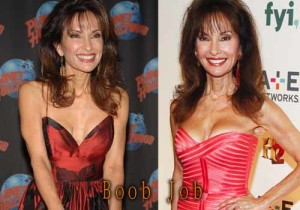Susan Lucci Plastic Surgery Before and After Facelift Pictures.