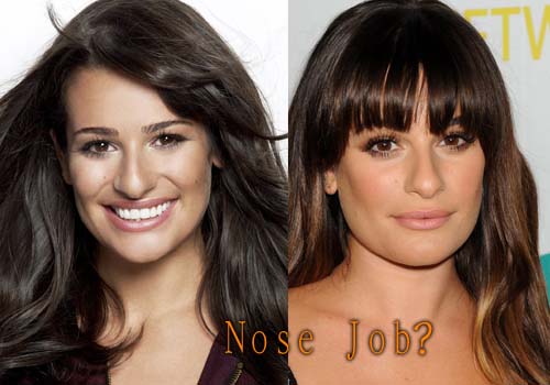 Lea Michele Plastic Surgery