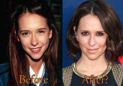 Jennifer Love Hewitt Plastic Surgery Before After Picture.