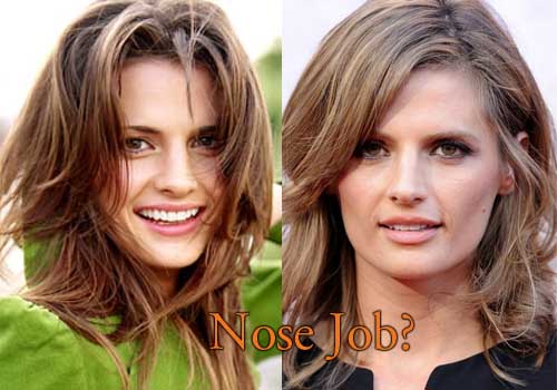 Stana Katic plastic surgery is widely spreading on many online media. 